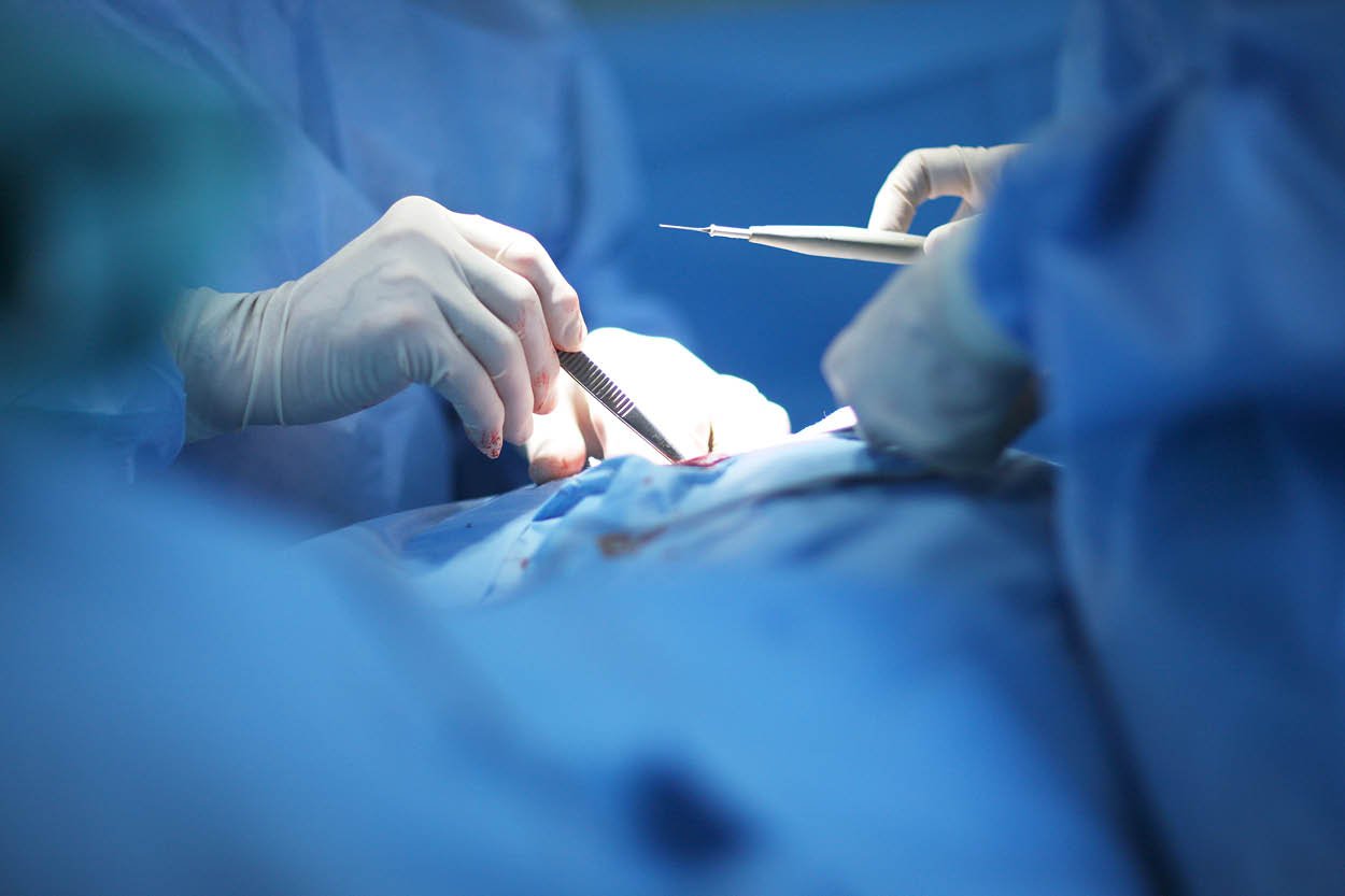 Оперативно лечение на щитовидната жлеза | Anadolu Medical Center
