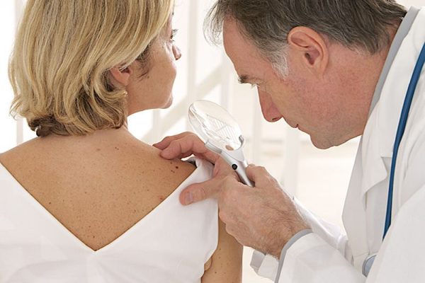 Внимание – меланом! | Anadolu Medical Center